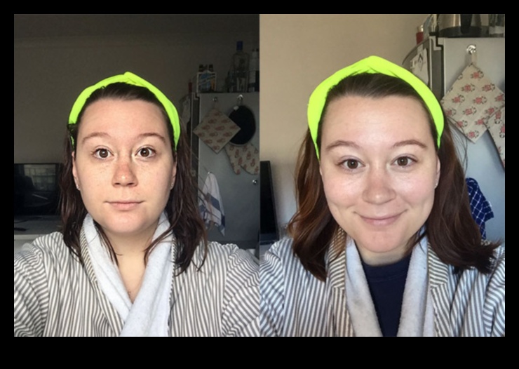 Η δίαιτα κετο βελτιώνει την υγεία του δέρματος 3 Η επίδραση της κετογονικής δίαιτας στην υγεία του δέρματος